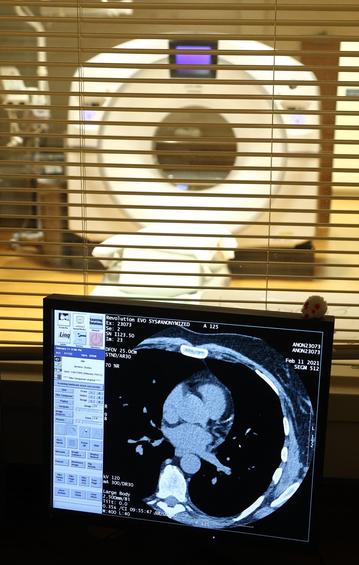 Screening Program for Franciscan Health Dyer-Munster